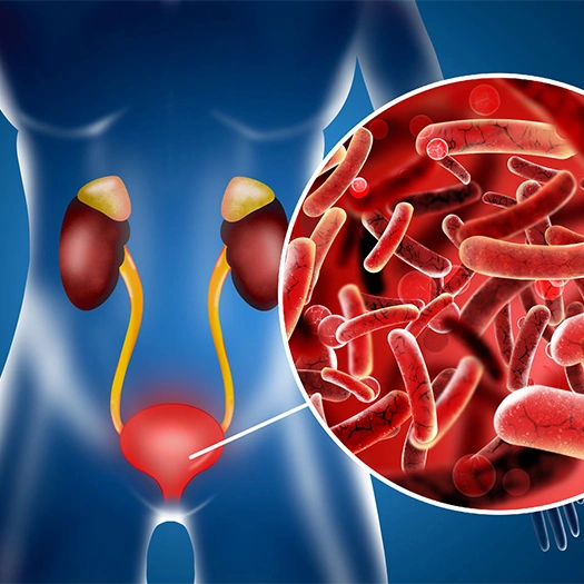 Blasenentzündungen werden meistens durch Bakterien verursacht, und meistens mit Antibiotika behandelt.